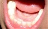 Researchers find Blood Clots can be caused by Dental Plaque Bacteria | Best Syndication | The Education S.T.R.E.a.M., Inc. | Scoop.it