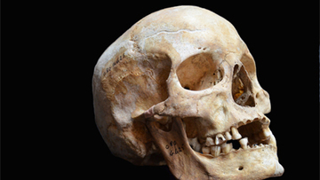 Ancient Leprosy Genome Reconstructed | Twisted Microbiology | Scoop.it