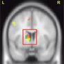 Le blogue du cerveau à tous les niveaux - An@é | Le petit journal de l'An@é | Scoop.it