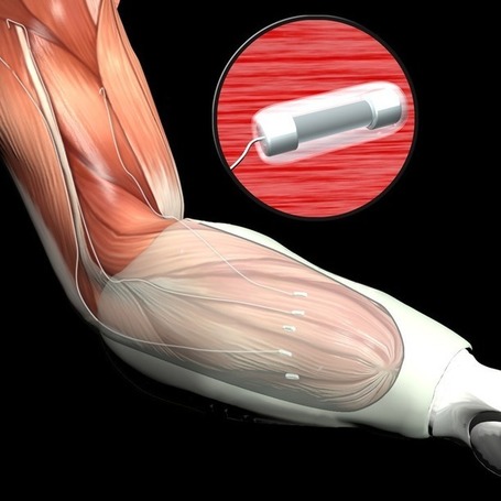New Technology Allows the Mind to Control Prosthetic Limbs - Mashable | Technological Sparks | Scoop.it