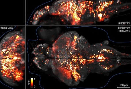 Whole brain cellular-level activity mapping in a second | Neuroscience_technics | Scoop.it