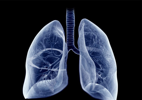 Une &eacute;tude fran&ccedil;aise perce le m&eacute;canisme d&rsquo;action d&rsquo;un m&eacute;dicament innovant chez des patients atteints d&rsquo;un cancer du poumon au stade avanc&eacute; | Life Sciences Universit&eacute; Paris-Saclay | Scoop.it