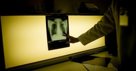 Fast, Cheap Testing for Tuberculosis? Soon It May Be Possible | Hospitals and Healthcare | Scoop.it