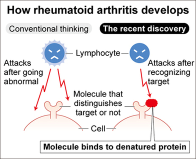 Study: Culprit leading to rheumatoid arthritis discovered | Immunopathology & Immunotherapy | Scoop.it