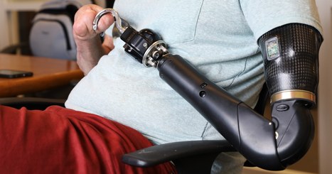 Deep learning is helping to make prosthetic arms behave more naturally  #hcsmeufr #esante #digitalhealth | GAFAMS, STARTUPS & INNOVATION IN HEALTHCARE by PHARMAGEEK | Scoop.it