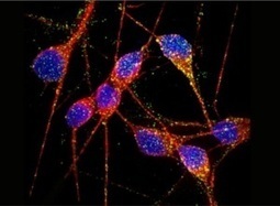 Transforming Skin Cells into Neurons Leads to New Insights for Alzheimer&rsquo;s | Singularity Hub | Longevity science | Scoop.it