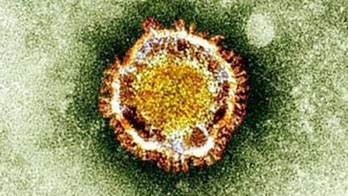 New virus 'not following Sars' path' | Complex Insight  - Understanding our world | Scoop.it