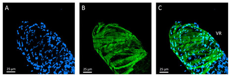 Comprendre l'évolution des facteurs de virulence chez les insectes parasitoïdes | EntomoNews | Scoop.it
