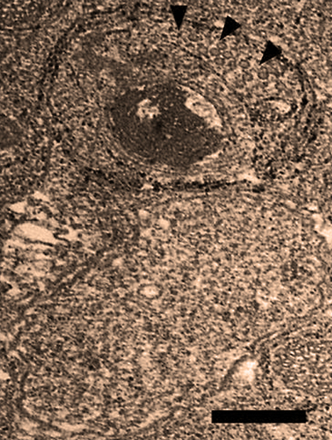 Un virus serait capable de voler de l'ADN à une veuve noire | EntomoNews | Scoop.it