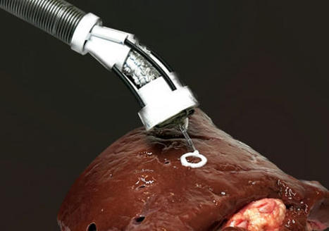 Robot Can 3D-Print Cells Inside a Patient’s Body During Surgery | Amazing Science | Scoop.it