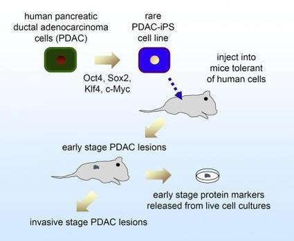 Pluripotent cells from pancreatic cancer cells first human model of cancer's progression | Longevity science | Scoop.it