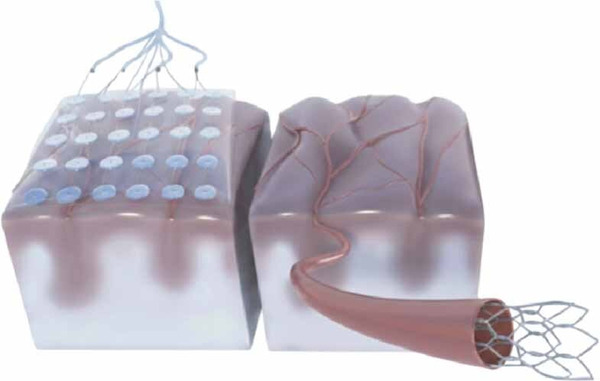 But do we need high bandwidth? Applications and scaling challenges of invasive brain&ndash;computer interfaces | Brain Computer Interfaces & connected medical devices | Scoop.it