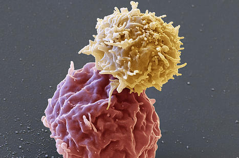 Explainer: What&rsquo;s behind FDA&rsquo;s concern that a cancer-fighting cell therapy can also cause the disease? | Science | AAAS | Genetic Engineering in the Press by GEG | Scoop.it