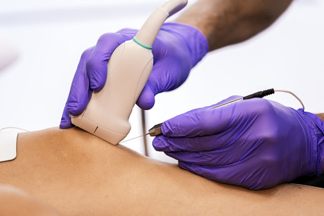 Percutaneous Tenotomy: Transforming Tendinopathy Care&nbsp;| Call 915-850-0900 or 915-412-6677 | Mobility & Flexibility - Joint Movement | Scoop.it