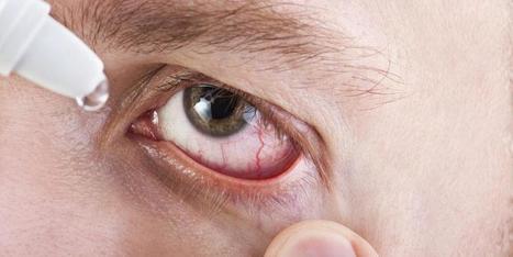 Consejos para prevenir el síndrome de ojo seco | DMedicina | Salud Visual 2.0 | Scoop.it