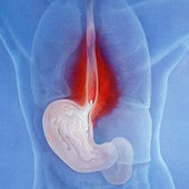 Magnesium tekort door maagzuurremmer - Leefwijzer | Voeding en het effect op hart en bloedvaten | Scoop.it