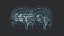 PAPEL - Las personas tenemos un segundo cerebro en el... | Facebook | Generalidades sobre Neurología | Scoop.it