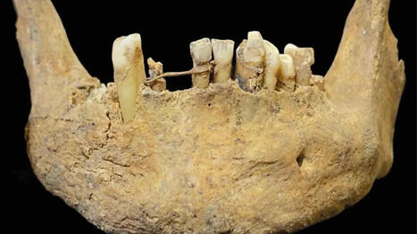 Un esqueleto en Escocia escond&iacute;a un secreto imposible: tecnolog&iacute;a dental siglos adelantada a su tiempo | Mi Caj&oacute;n de Ideas | Scoop.it