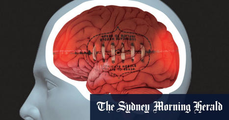 Concussion and CTE: AFL brain disease cases ‘tip of the iceberg’, says US expert Dr Chris Nowinski | eParenting and Parenting in the 21st Century | Scoop.it