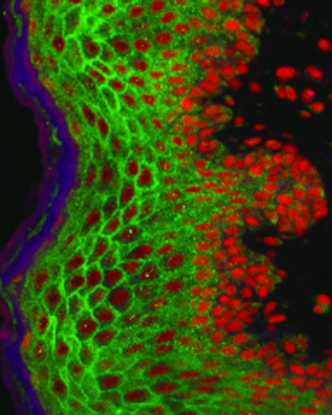 Beyond Blood: What are Mucosal and Genital Study Specimens ... | Mucosal Immunity | Scoop.it