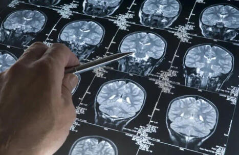 Alzheimer: descubren el 'caballo de Troya' celular que la enfermedad utiliza para destruir el cerebro | Alzheimer y m&aacute;s (Bolet&iacute;n n&ordm; 93) | Scoop.it