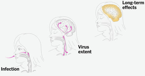 How Measles Attacks an Unvaccinated Child - The New York Times | One Health News: salute, ambiente e società - A cura di ISDE, Festival della salute, Marketing sociale. N°15 | Scoop.it