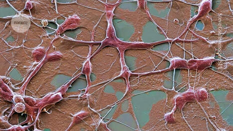 Brain cells given an ‘invisibility cloak’ fix Parkinson’s symptoms in rats - Nature | Genetic Engineering Publications - GEG Tech top picks | Scoop.it