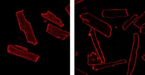 Un antid&eacute;presseur pour d&eacute;tubuler les cardiomyocytes ! | Life Sciences Universit&eacute; Paris-Saclay | Scoop.it