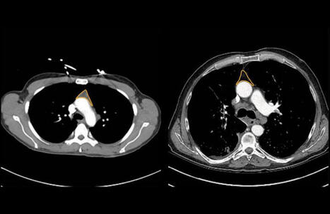 Thymus May Be Critical for Longevity and Cancer Immunotherapy Response | Vincent Geenen | AUTOIMMUNITY | Scoop.it