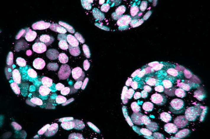 IVF embryos may thrive when grown with less oxygen | The Health Report | Scoop.it