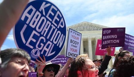 États-Unis : en réponse aux lois anti-IVG, une élue propose la vasectomie obligatoire | Famille et sexualité | Scoop.it
