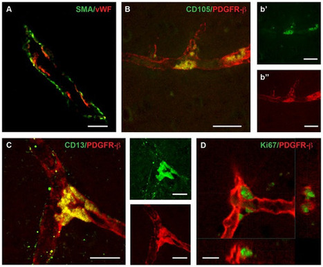 New stem cell type found in the brain | Amazing Science | Scoop.it