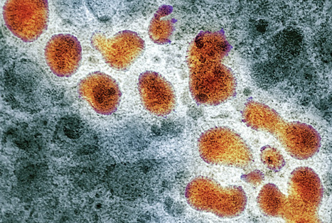 Could the Bird Flu Become Airborne? - The New York Times | Virus World | Scoop.it