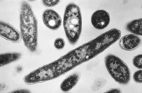 Legionella Found in US Government Office Building | Industry 411 - Waste Management | Scoop.it