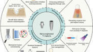 Clinical translation of personalized bioengineered implant scaffolds | Nature Reviews Bioengineering | Immunology and Biotherapies | Scoop.it