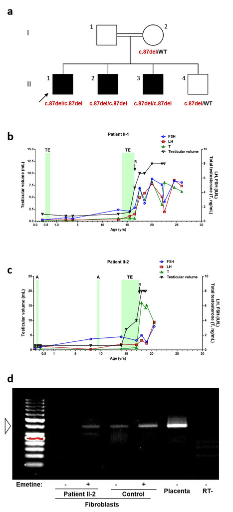 Récupération de la fonction gonadotrope chez deux frères porteurs d'une nouvelle mutation de KISS1 | Life Sciences Université Paris-Saclay | Scoop.it