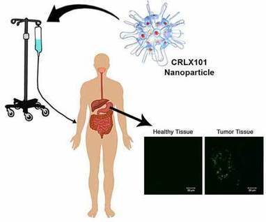 Nanoparticle-based cancer therapies shown to work in humans | #Research #Medicine | 21st Century Innovative Technologies and Developments as also discoveries, curiosity ( insolite)... | Scoop.it
