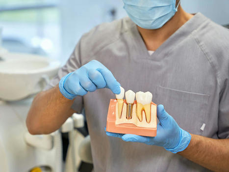 My Dental Implant Feels Loose – What Should I Do? | Smilepoint Dental Group | Scoop.it