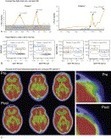 Remission of Disseminated Cancer After Systemic Oncolytic Virotherapy - Mayo Clinic Proceedings | Genetic Engineering Publications - GEG Tech top picks | Scoop.it