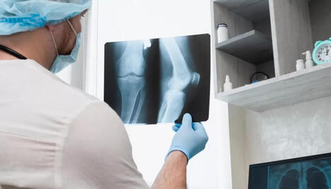 [L'Opinion Indépendante] Toulouse : la moésine, cette molécule qui pourrait révolutionner la lutte contre les maladies osseuses | Les laboratoires du CNRS Occitanie Ouest dans la presse | Scoop.it