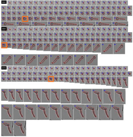 A Systematic Method for Analysing Germination of Aspergillus Conidia Using Real-Time Imaging | RMH | Scoop.it