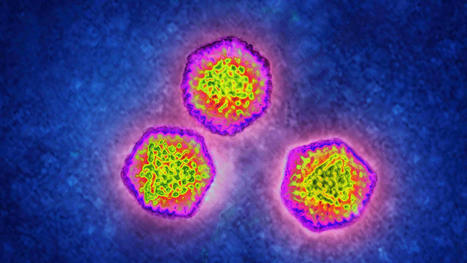 'Long Colds' Could Be as Common as 'Long Covid' - Study | Virus World | Scoop.it