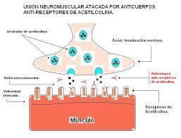 Diagnostic and clinical classification of autoimmune myasthenia gravis | Immunology Diagnosis | Scoop.it