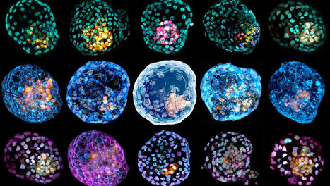 Genforschung: Forscher erschaffen menschliche Embryonenmodelle im Labor | #Research #Ethics | 21st Century Learning and Teaching | Scoop.it