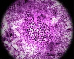 Le virus West Nile continue de circuler au Canada | EntomoNews | Scoop.it