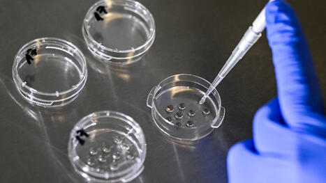 "Il faut se rendre compte de la souffrance des gens": des soignants et des associations plaident pour l&rsquo;autorisation d&rsquo;une technique qui pourrait limiter les &eacute;checs en parcours PMA | Bio&eacute;thique & Procr&eacute;ation | Scoop.it