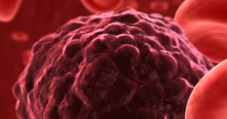 Krankheit schmolz regelrecht dahin: US-Forscher bauen Blut zu Krebs-Zerstörer um | #Research #Cancer  | 21st Century Innovative Technologies and Developments as also discoveries, curiosity ( insolite)... | Scoop.it