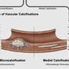 Critical Limb-Threatening Ischemia (CLTI)