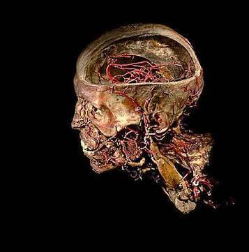 Burke's skeleton to human body parts: New app opens up University of Edinburgh’s Anatomical Collections | Culture24 | Everything open | Scoop.it