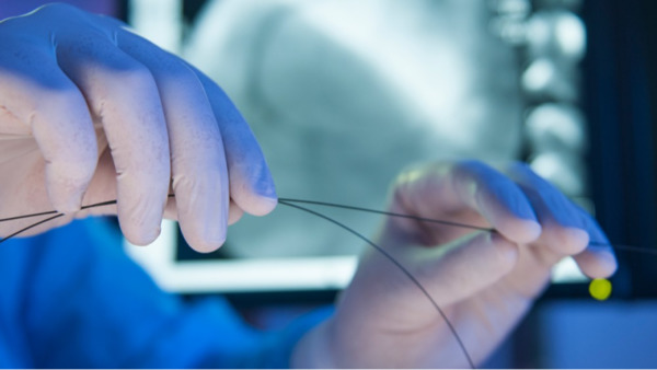 Everything To Know About Minimally Invasive Structural Interventions | Transcatheter Treatment of Mitral Regurgitation | Scoop.it